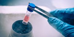 حفظ الخصوبة: استكشاف خيارات تجميد البويضات والحيوانات المنوية